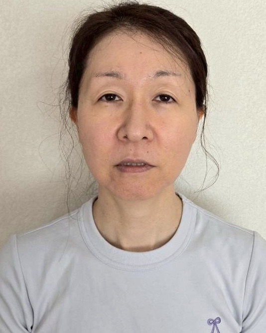 新潟県　40代　A様