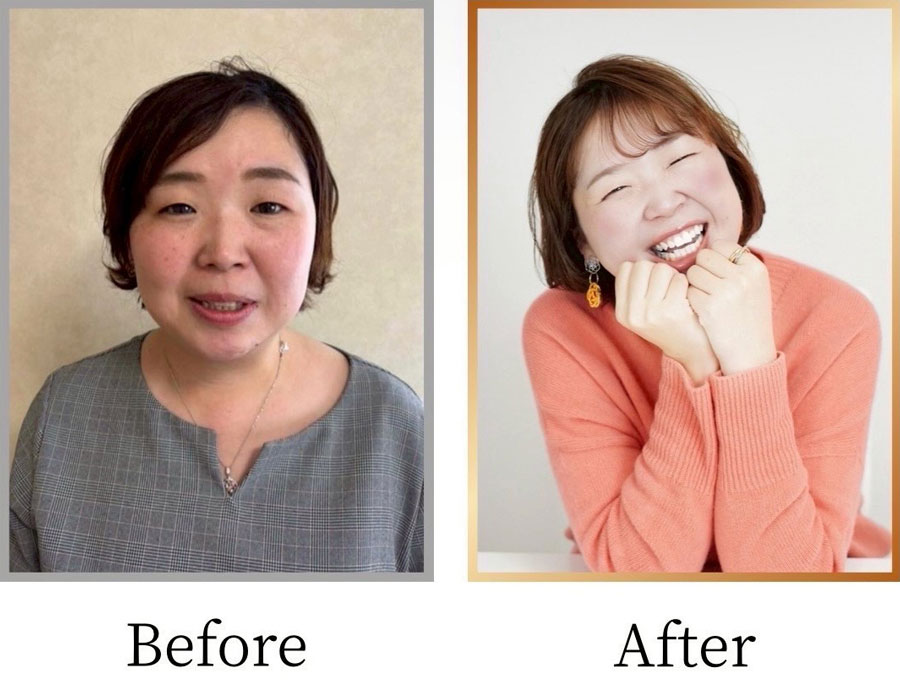Before/After画像