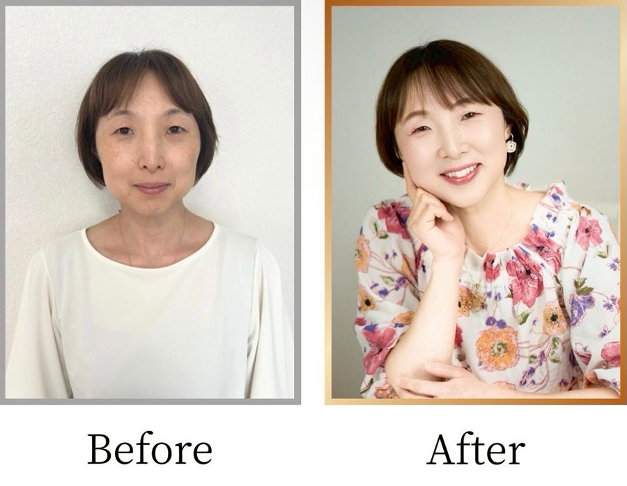 Before/After画像