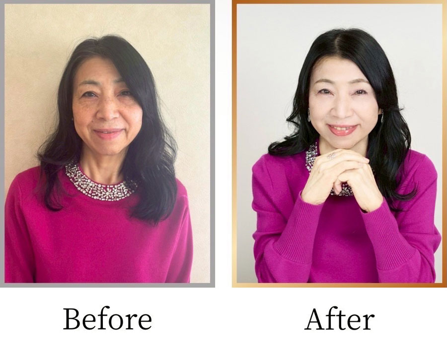 Before/After画像