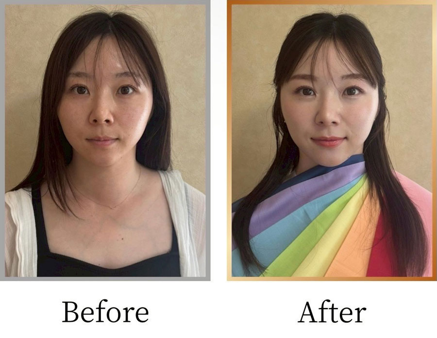 Before/After画像