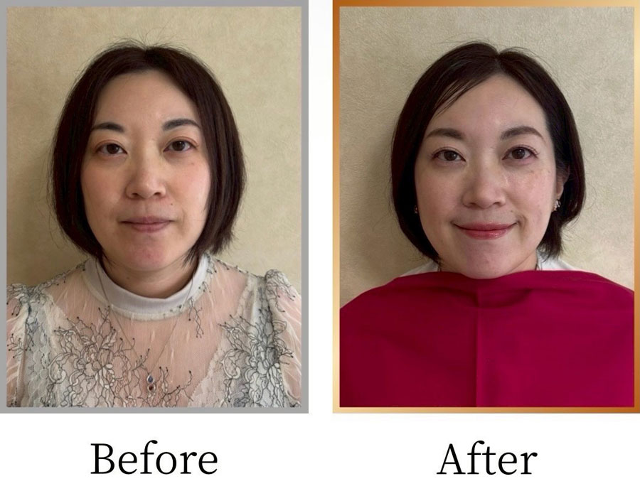Before/After画像