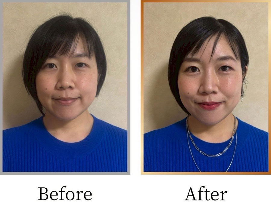 Before/After画像