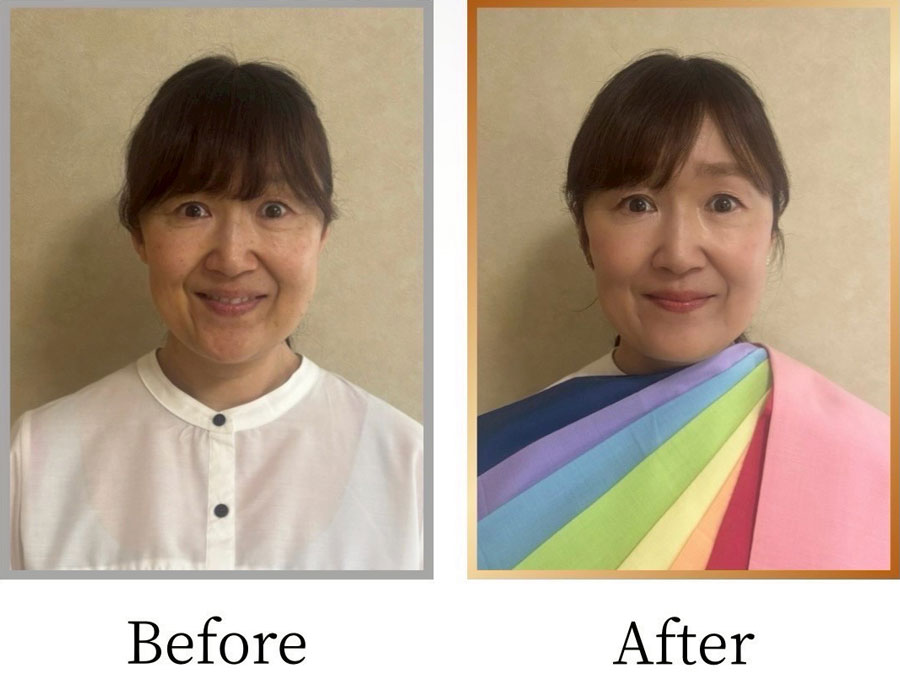 Before/After画像