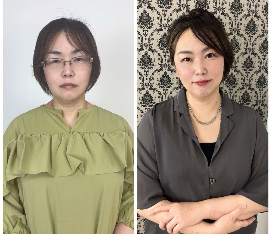 Before/After画像