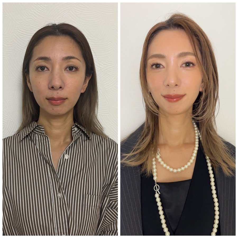 Before/After画像