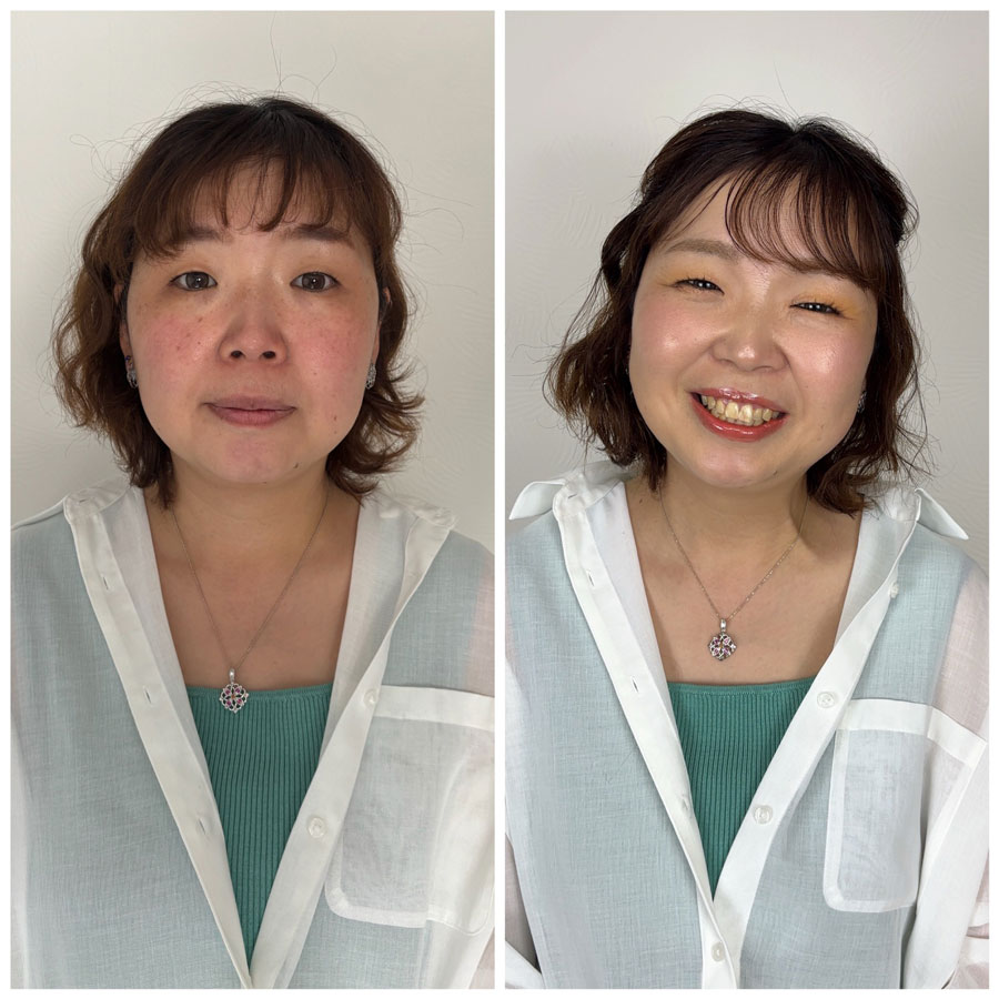 Before/After画像