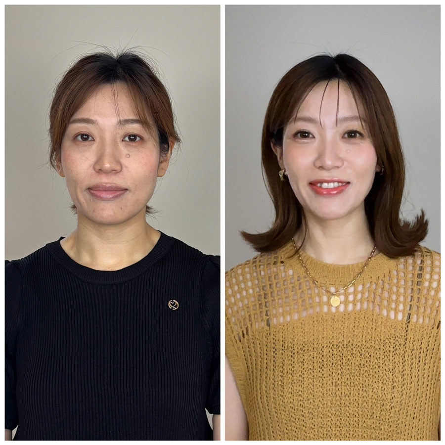 Before/After画像